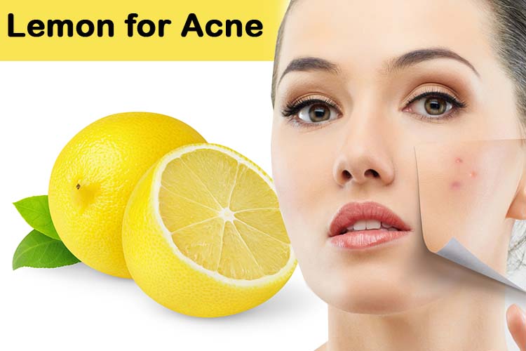 how to remove acne scars